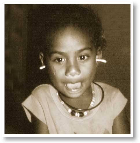 Child with tissue spears in both ears