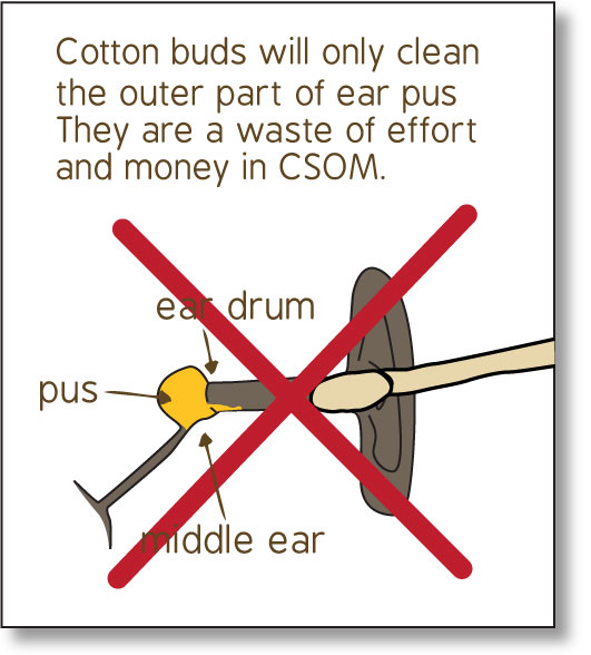 Diagram of the human ear - cotton buds cannot reach the pus in the middle ear and are a waste of money.
