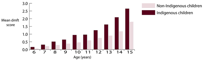 Average number of decayed, missing, and filled permanent teeth for Indigenous and non-Indigenous children aged 6 to 15 years, NSW, SA and the NT, 2000-2003